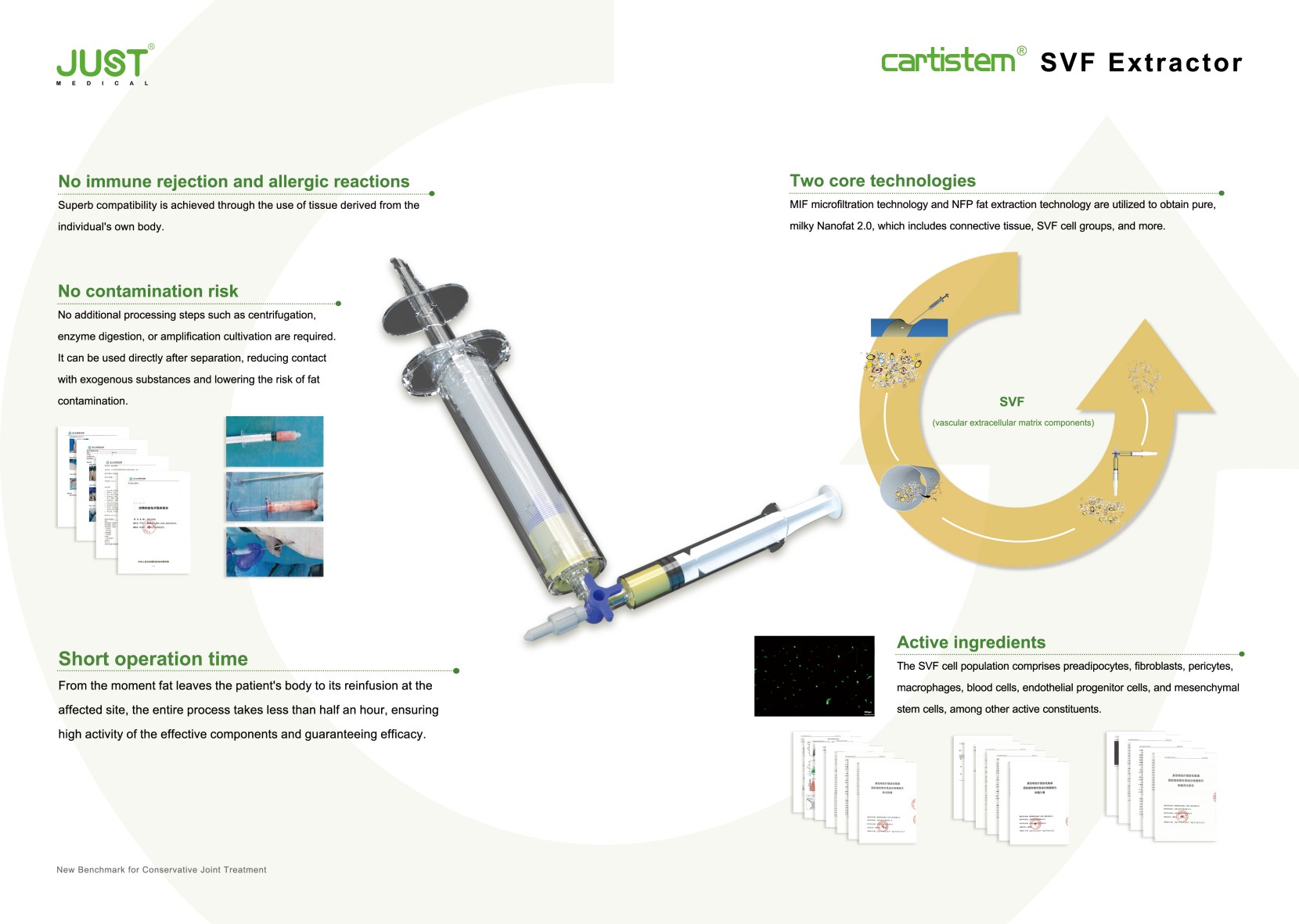 JUST Innovative Product Recommendation: Progress of the Cartistem® SVF Adipose Collector in Thailand