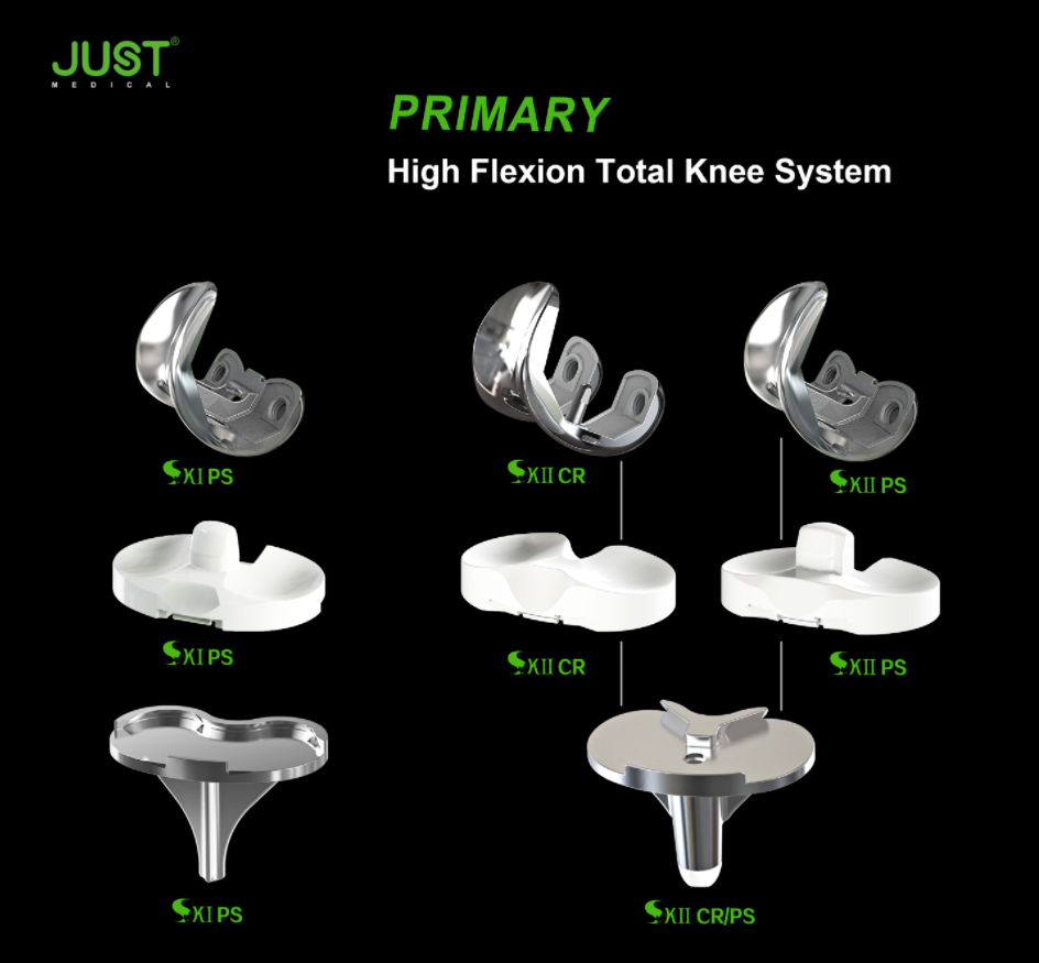 JUST SKII PS Total Knee Revision Surgery Case Study